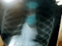 Em 2005 referências à dengue eram alarmismos inaceitáveis