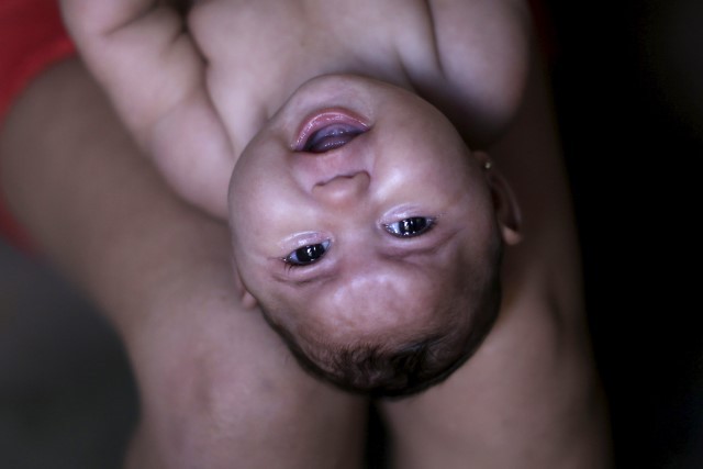 Aumenta para 508 número de casos confirmados de bebés com microcefalia no Brasil