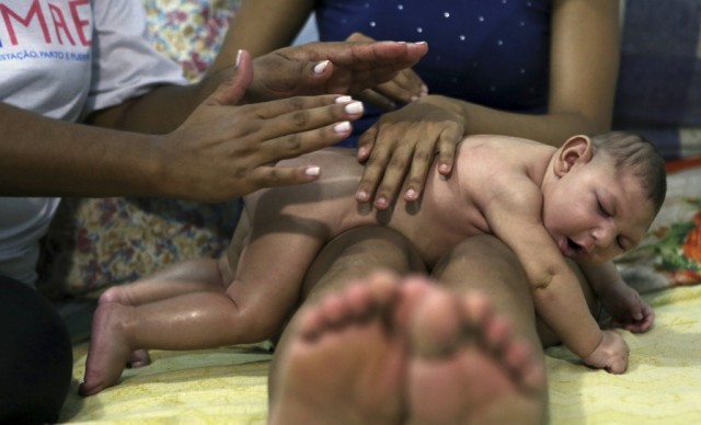Cientistas apresentam hipótese de como o vírus Zika poderá provocar microcefalia