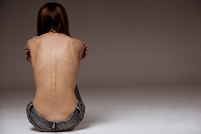 Anorexia, uma dependência e não medo de engordar