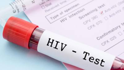 Adolescentes em tratamento de VIH na África do Sul cresce fortemente desde 2010