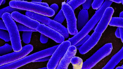 Bactéria ‘E. coli’ detectada em suplemento alimentar à venda em farmácias