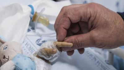 Barreiras na saúde diminuem mas ainda há grandes disparidades entre ricos e pobres