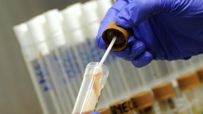 Cientistas norte-americanos anunciam novo antibiótico para bactérias multi-resistentes