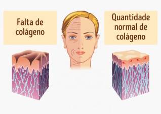 Colagénio, retarda o envelhecimento?