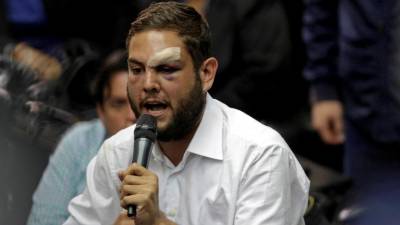 Deputado venezuelano acusado de atentar contra Maduro falou pela primeira vez com família