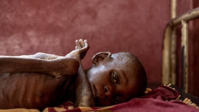 Duas em cada três crianças na República Centro-Africana precisam de assistência humanitária