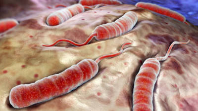 Epidemia de listeriose mata 172 pessoas na África do Sul