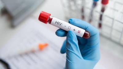 África do Sul prepara lançamento de novo tratamento contra o HIV