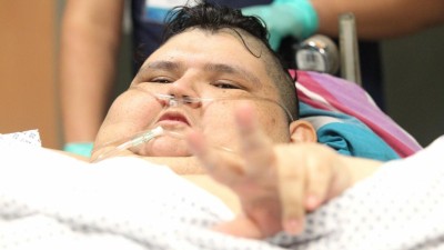 Homem mais obeso do mundo sujeito a cirurgia para reduzir estômago