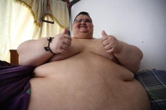 Homem mais obeso do mundo vai ser operado no México depois de perder 175 quilos