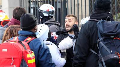 Manifestante perde uma mão durante confrontos em Paris