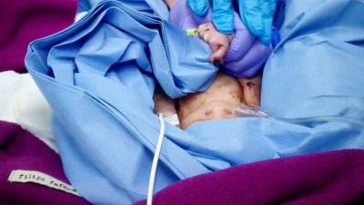 Mãe que abandonou recém-nascido em caixote do lixo agiu sozinha e vivia na rua