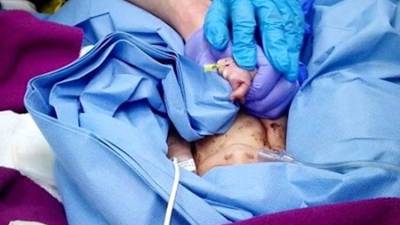 Mãe que abandonou recém-nascido no caixote do lixo em Lisboa em prisão preventiva