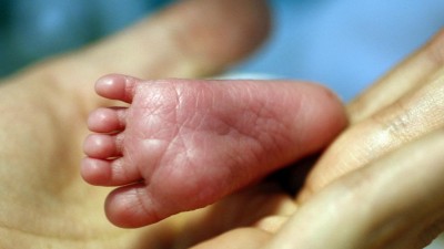Medicamento para epilepsia terá causado mais de duas mil malformações congénitas em França