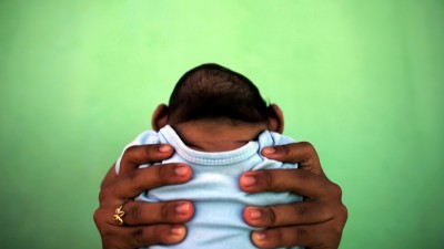 OMS estima mais de mil novos casos de microcefalia no Brasil