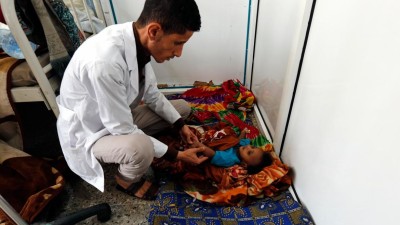 ONU alerta para risco de mortos “em massa” devido à fome em África e no Iémen