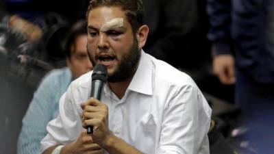 Oposição denuncia tortura a deputado acusado de participar em atentado contra Maduro