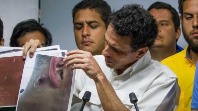 Oposição fala em mais de 250 feridos em protesto em Caracas