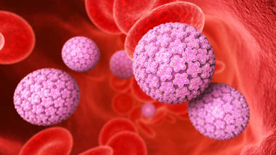 Patologista alerta para aumento de casos de cancro da cabeça e pescoço por HPV