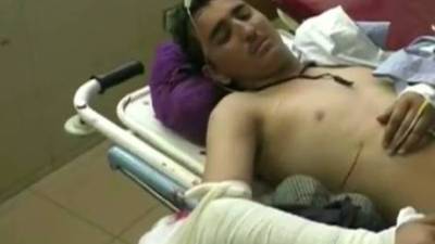 Pelo menos sete pessoas morrem em ataque suicida contra casamento no Afeganistão