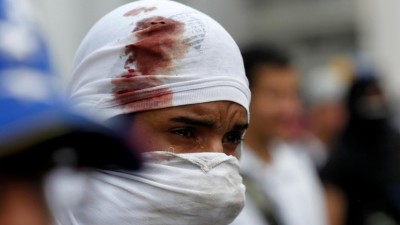 Pelo menos um morto, 19 feridos e 30 detidos em protestos na Venezuela