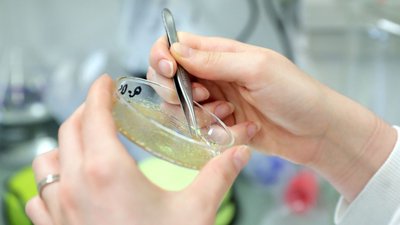 Surto de listeriose já infectou 186 pessoas em Espanha